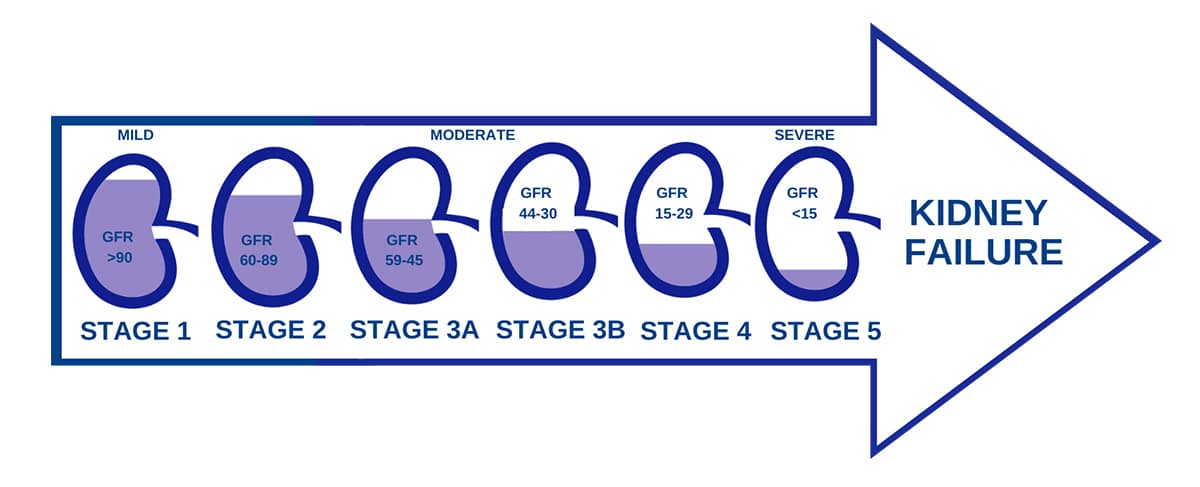 Stages of kidney disease